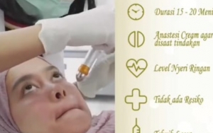 Tidak Lupa Melakukan Laser <i>Glowing</i>