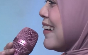 Memakai Kawat Gigi