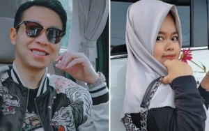 Dokter Richard Lee Bongkar Perjuangan Kekeyi OTW Glow Up, Bagian Gigi Bikin Salah Fokus