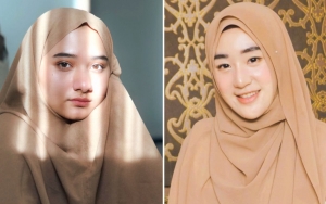 Nikahi Adik Alvin Faiz, Wajah Nadzira Shafa Tanpa Make-Up Cantik Alami Tak Kalah dari Larissa Chou