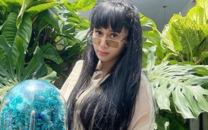 Denise Chariesta Kini Berterima Kasih ke Dewi Persik Usai Diejek 'Ketiak Item', Kenapa?