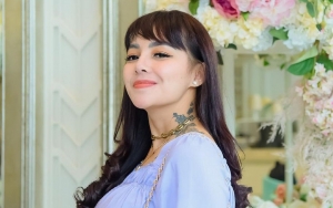 Alami KDRT Saat Positif COVID-19, Nadia Christina Perlihatkan Lebam di Sekujur Tubuhnya