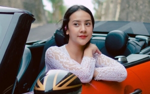 Anya Geraldine Pamer Wajah Asli Tanpa Makeup, Gaya Foto Justru Bikin Salfok