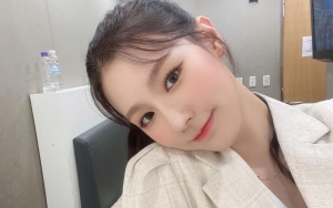 Miyeon (G)I-DLE Disebut Makin Cantik Bukan Karena Operasi Plastik, Seperti Apa?
