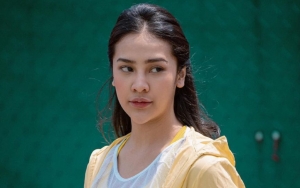 Anya Geraldine Alami Cedera Kaki, Begini Reaksinya Saat Ditertawakan Teman-Teman