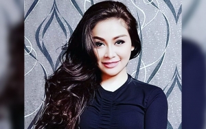 Alami Luka di Wajah, Kronologi Virnie Ismail Kecelakaan Sepeda Hingga Terpental Terungkap