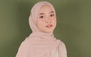 Sempat Pamer Jerawat, Kini Nissa Sabyan Tampil dengan Wajah Mulus Banjir Pujian