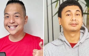 Ernest Prakasa Tuding Jadi 'Gembong' Narkoba Komika, Begini Reaksi Raditya Dika