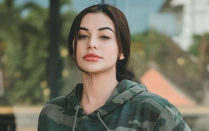 Wajah Nora Alexandra Lebam Diduga Karena Pukulan, Begini Faktanya