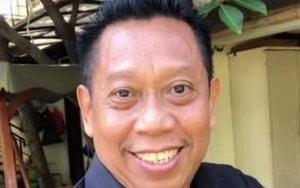 Pihak RS Tegas Bantah Tukul Arwana Pendarahan Otak Karena Efek Vaksin Covid-19