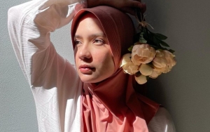 Putri Anne Kena Nyinyir Saat Kembali Perawatan Wajah Usai 2 Tahun Absen, Balas Begini