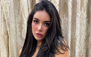 Millendaru Pajang Foto Seksi, Bentuk Bibir Justru Jadi Sorotan Disebut Aneh