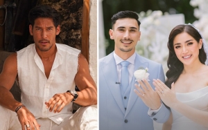 Bagian Mata Richard Kyle Jadi Sorotan di Unggahan Terbaru, Sedih Jessica Iskandar Menikah?