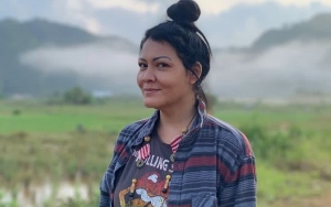 Tumor Di Perut Pecah, Rahim Melanie Subono Alami Pembengkakan Hingga 1,3 Kg