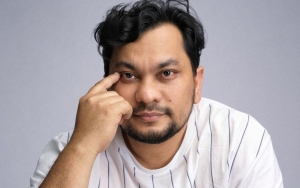 Tompi Komentari Soal Operasi Plastik Dianggap Dosa Dalam Islam, Penjelasannya Tak Terduga