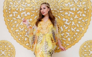 Akun Instagram Emma Waroka Mendadak Hilang Usai Ikut Kecam Keluarga Vanessa Angel 