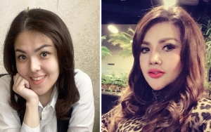 Tina Toon Pamer Wajah Tirus Dikira Oplas Mirip Barbie Kumalasari, Reaksi Bareng Ibu Bikin Ngakak