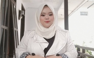 Rahmawati Kekeyi Ungkap Rasa Bangga Punya Gigi Langka Sebagai Ciri Khas Dirinya