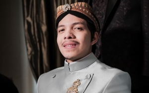Tak Hanya Anang Hermansyah, Atta Halilintar Juga Jalani Transplantasi Rambut 
