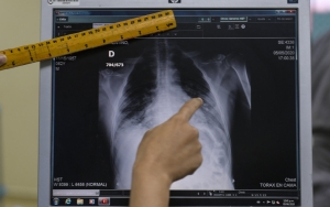 Dokter Bedah Prancis Jadi Sorotan Usai Jual Foto Rontgen Pasien di Lapak NFT