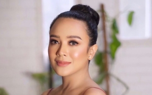 Dea Ananda Bongkar Rahasia Wajah Berubah hingga Sempat Dikira Operasi Plastik