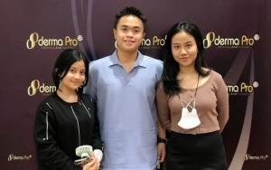 Dokter Kecantikan Mayang-Chika Mendadak Viral, Wajah Sebelum Glow-Up Bikin Salfok