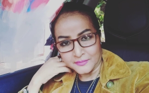 Kepala Machica Mochtar Alami Retak Usai Jadi Korban Tabrak Lari, Kenapa Tak Lapor Polisi?