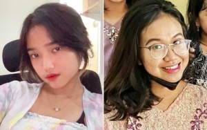Fuji Mellow Sambut 100 Hari Vanessa Angel-Bibi, Mayang Malah Pamer 'Mimisan Berdarah'?