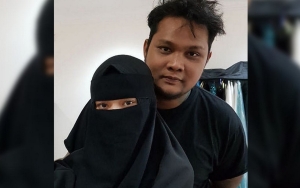 Foto Tanpa Hijab Disebar, Istri Virgoun Akui Kena Mental