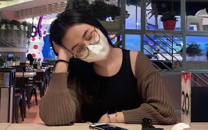 Mayang Ngotot Jadi Korban Skincare Usai 'Dituntut' Minta Maaf, Dokter Kecantikan Buka Suara?