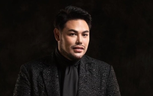 Alami Kecelakaan, Ivan Gunawan Akui Bagian Ini Kena Imbas Hingga 'Pitak'