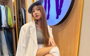 Belum Final, Lucinta Luna Sebut Dalam 3 Bulan Wajahnya Akan Jadi 10 Tahun Lebih Muda 