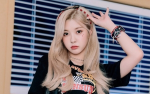 Kim Dayeon Kep1er Jatuh dari Panggung, Reaksi Kontestan 'Queendom 2' Lain Picu Haru