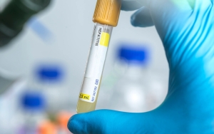 Anak-anak Jadi 'Sasaran Empuk' Hepatitis Misterius, Epidemiolog Ungkap Penyebabnya