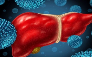 Diduga Ada Kasus Tambahan Hepatitis Akut Misterius di Jakarta, Masih Diselidiki IDAI