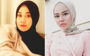 Puput Ungkit Medina Zein Kasih Tas 500 Juta 'Bekas' Vanessa Angel dan Cincin Berlian 55 Juta, Palsu?