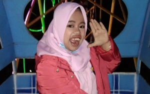 Biasa Kalem, Rahmawati Kekeyi Balas Menohok Alasan Tak Mau Pasang Kawat Gigi: Capek Jelasin