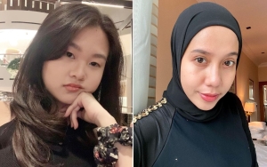 Felicia Tissue Hempas Isu Disentil Nadya 'Eks Kaesang', Foto Tenteng Tas Kelas Dunia Bikin Salfok