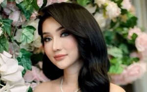 Lucinta Luna Pamer Foto Diperban Diduga Oplas Lagi, Penampakan Bibir Berdarah Bikin Ngeri