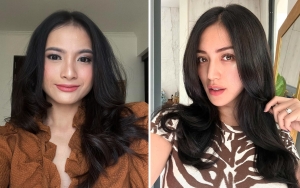 Diberi Gelar Aktris Termahal, Acha Septriasa Cerita Pernah 'Didepak' Jessica Iskandar