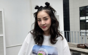 Berat Badan Sandara Park Turun 10 Kg Hingga Jadi 37Kg, Ini Alasan Fans Tak Usah Khawatir