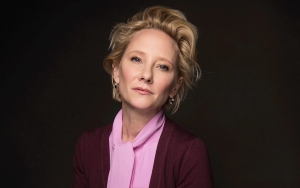 Anne Heche Meninggal Akibat Kecelakaan, Sempat Dinyatakan Tak Punya Harapan Hidup