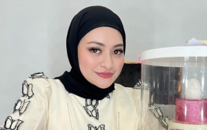Sama Cantiknya, Nathalie Holshcer Disebut Bak Kembar dengan Sosok Artis Ini