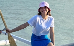 Farida Nurhan Bagikan Penampakan Hidung Pasca Tiga Kali Jalani Operasi