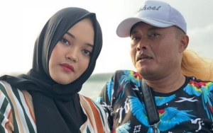  Dibully Saat SMP, Putri Delina Pernah Malu Jadi Anak Sule