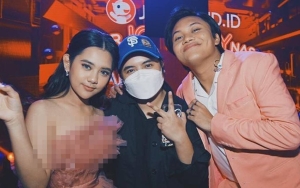 Ziva Magnolya Disalahkan Usai Rizky Febian Diisukan Tak Profesional, Kakak Pasang Badan