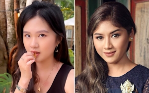 Isu Kaesang-Felicia Tissue Viral, Erina Gudono Justru Curhat Tepar Usai Operasi