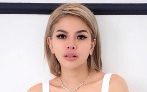 Dirawat di RS, Nikita Mirzani Malah Minta Dipulangkan ke Rutan Gara-gara Sendok