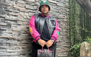 Ivan Gunawan Unggah Foto Baru, Bentuk Bibir Jadi Sorotan
