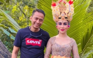 Doddy Sudrajat Bikin Mayang Tuai Simpati Gara-gara Operasi Hidung